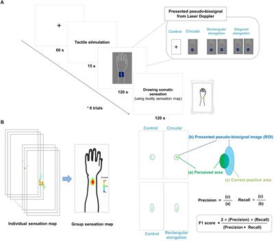 Expectations of the Physiological Responses Can Change the Somatosensory Experience for Acupuncture Stimulation